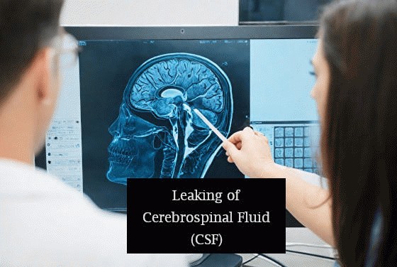 cerebrospinal fluid leak in brain after head trauma